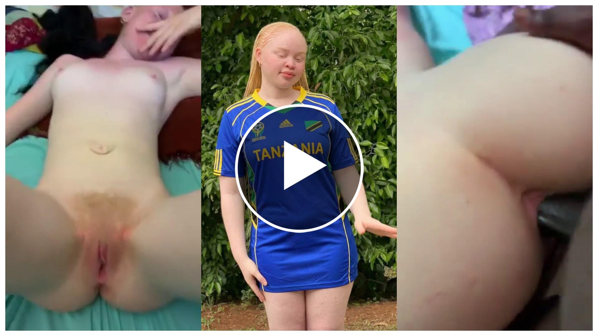 Mwanafunzi Albino wa chuo cha NIT connection hii hapa